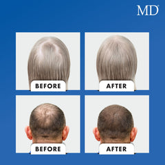 MD Nutri flaxseed powder represents scalp and hair root nourishment