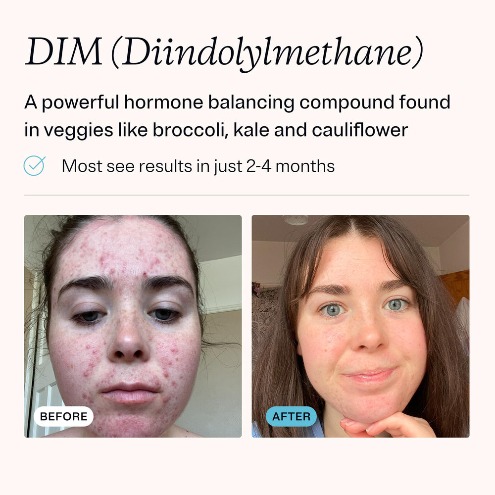 MDacne DIM ingredients with cruciferous powders for hormonal balance support.