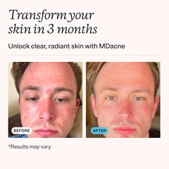 Front packaging of MDacne vitamins showcases dermatologist-formulated, cruelty-free skincare support.