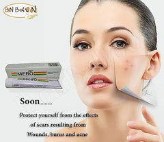 Close-up of MEBO Burn Cream label and ingredients