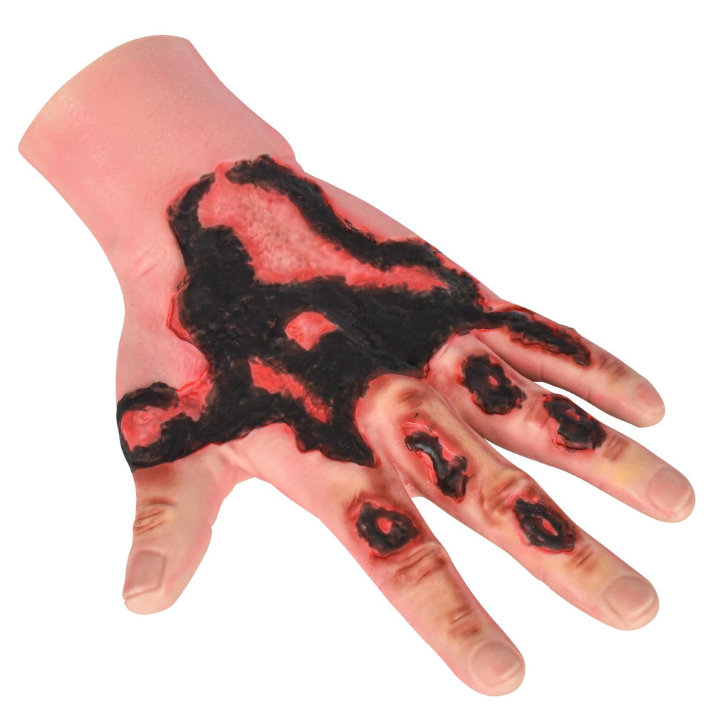 MedEduQuest burn wound packing trainer on the hand for realistic practice