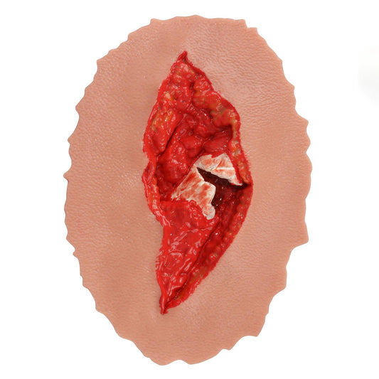 MedEduQuest Open Fracture Wound Trainer offers lifelike practice for open fracture care