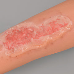 MedEduQuest wound packing trainer sleeve supports safe technique rehearsal.