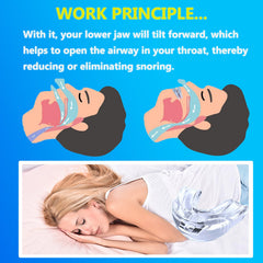 MFANBLAS anti-snore case with mouthpiece for travel and hygiene