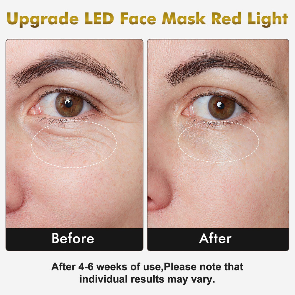 neck mask with 99 LEDs shown side view for synchronized facial-neck treatment