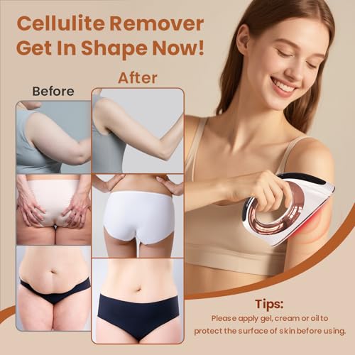 Mozoss cellulite massager targeting waist may help with contouring and skin appearance at home.