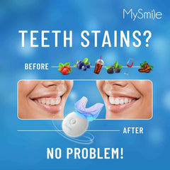 MySmile after whitening smile highlighting visible improvement.