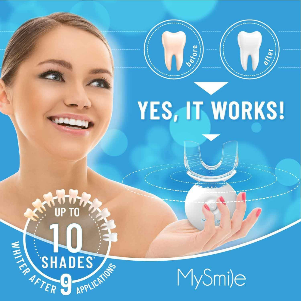 MySmile LED light in action during teeth whitening at home.