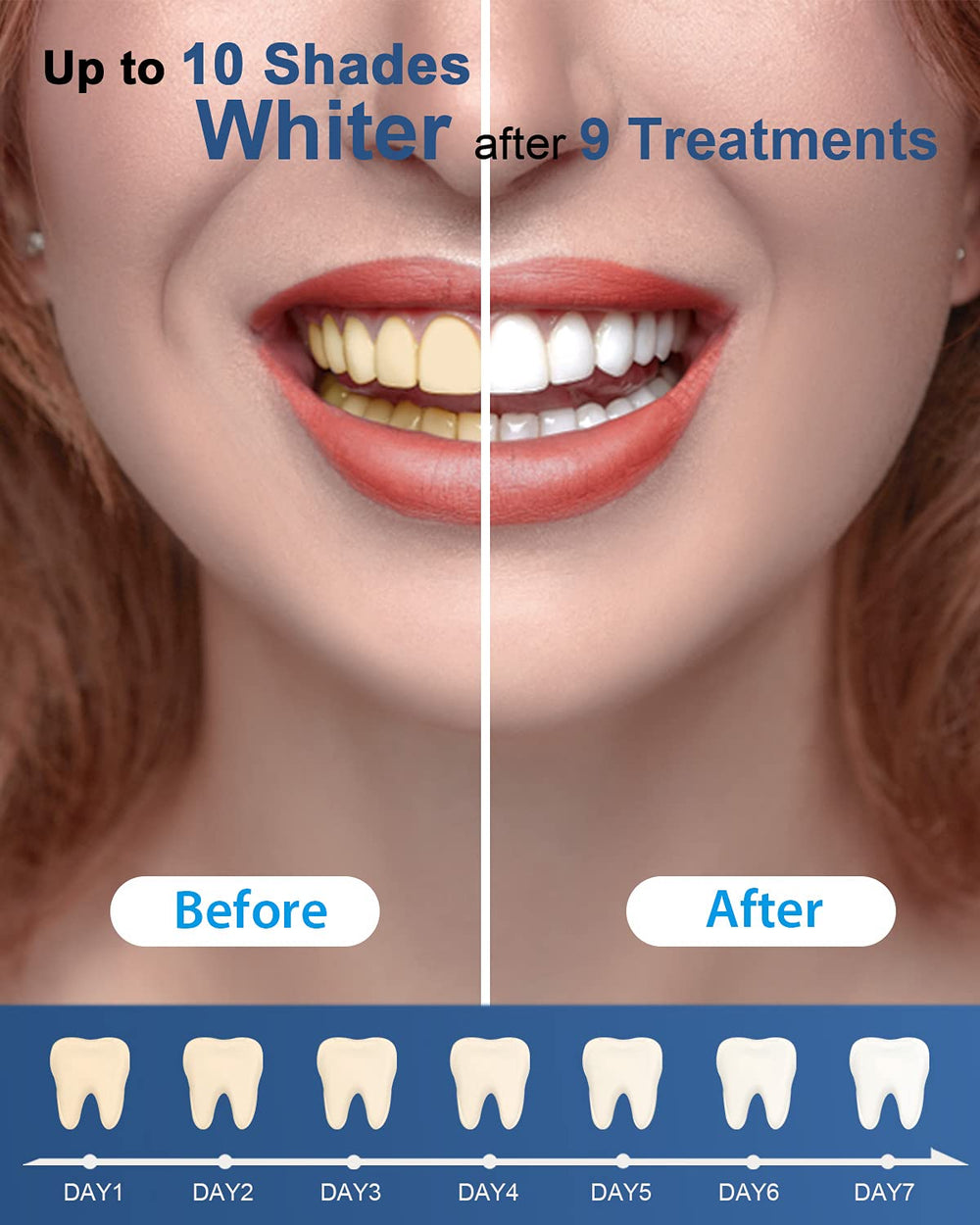 MySmile gel helps lift stains from coffee, wine, and tea.
