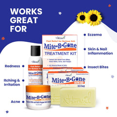 Person applying Naturasil Mite-B-Gone lotion for quick comfort