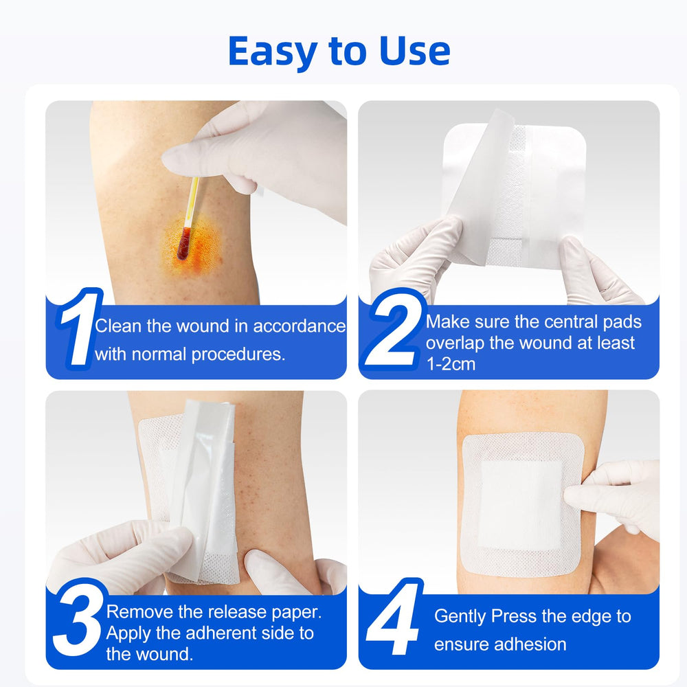 Absorbent exudate management with Niceful island dressing.