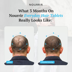 NOURRIR scalp nourishment visual highlighting hair vitality support