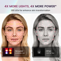 Novurial cordless mask enables freedom of movement during sessions