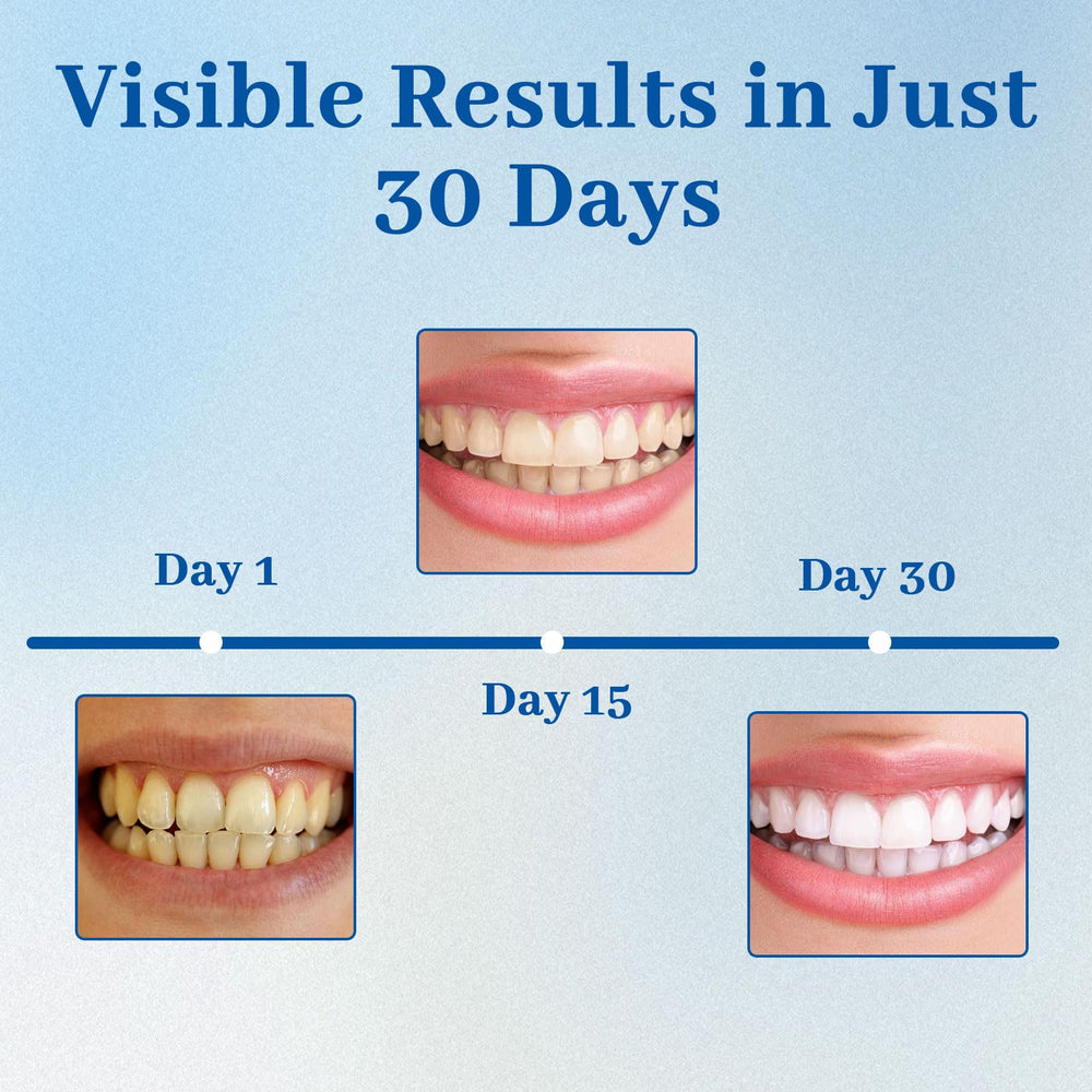 NUDENTA Odontic Repair enamel glow visual after remineralization.