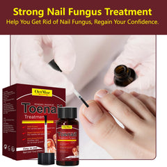 OETMOE healthier looking nails after regular use