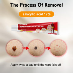 Applying OJIOG gel directly to the wart for targeted treatment