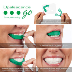 Opalescence Go top and bottom trays for full-mouth whitening