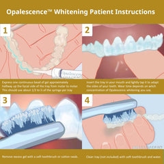 Opalescence USA-made by Ultradent ensures professional quality