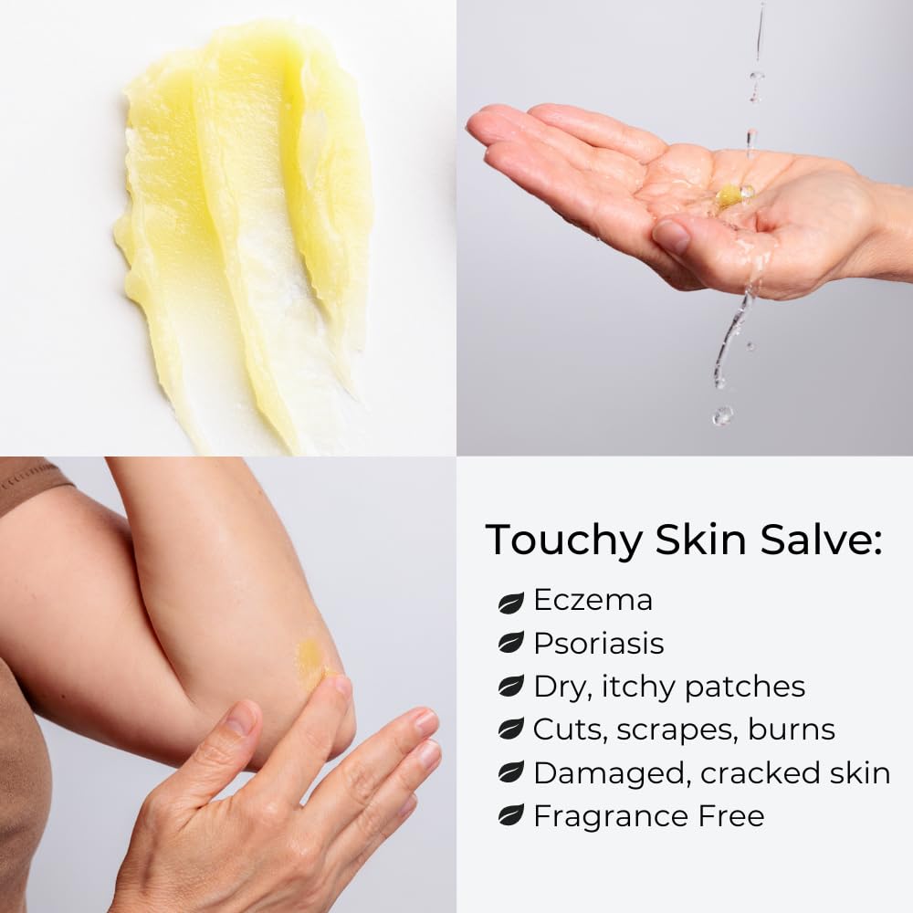 Ora's Amazing Herbal Touchy Skin Salve for dry winter skin application.