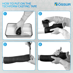Össur Techform Premium Casting Tape on a patient arm illustrates quick, comfortable casting for immobilization.