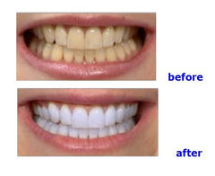 OUBO YS-TW-A whitening gel compatibility with standard gels