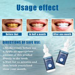 OUHENGTEK shielding layer on enamel demonstrates protective barrier effect.