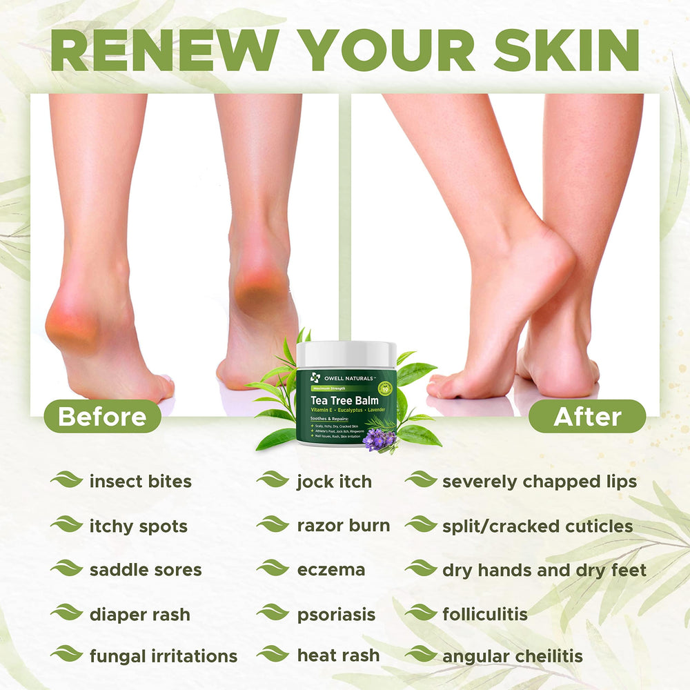Owell Naturals Tea Tree Balm close-up texture reveals creamy, quick-absorbing formula.