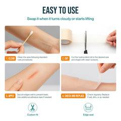 Patch4U hydrocolloid roll ideal for burns and early bedsores.