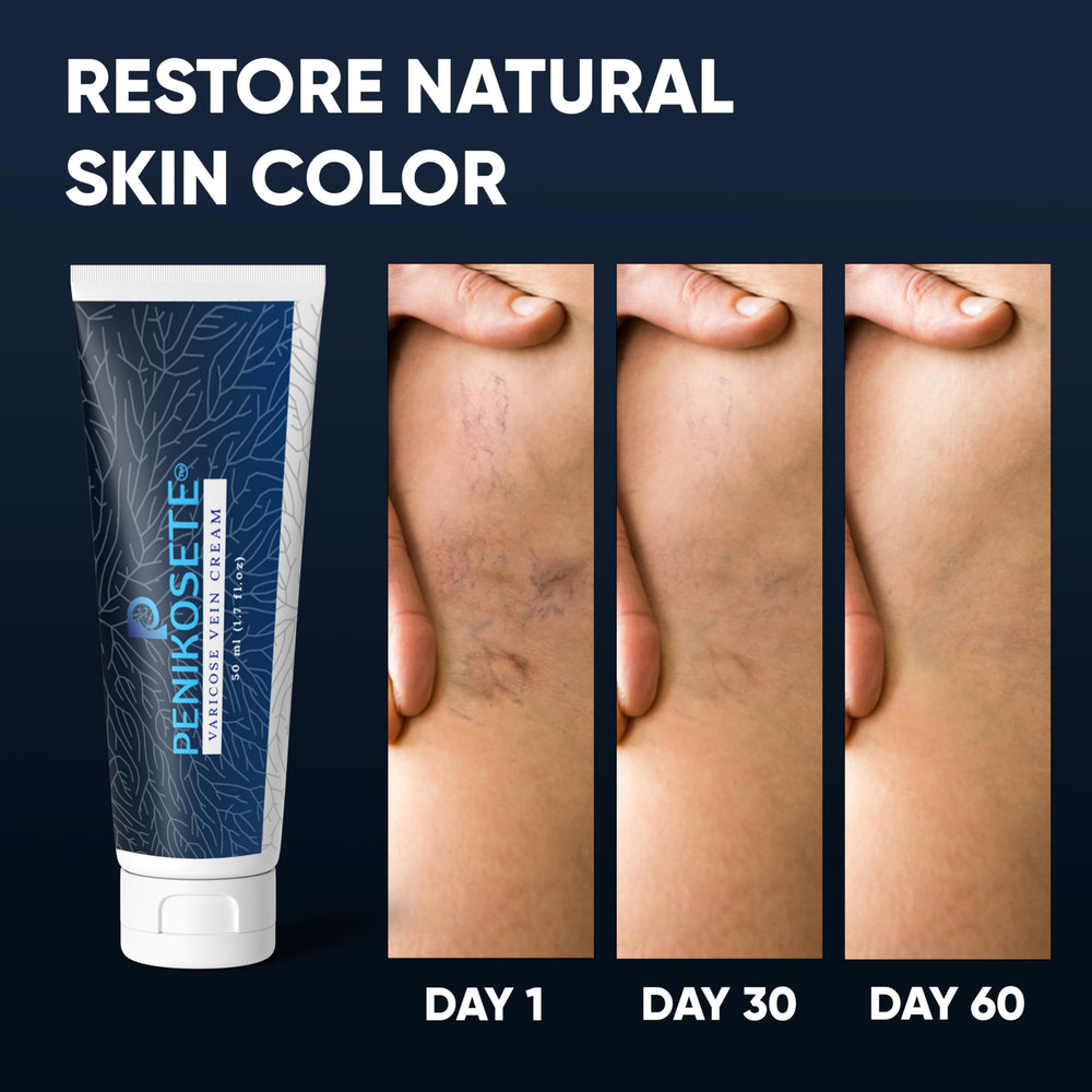 Penikosete jet-setter leg care emphasizes travel-friendly support