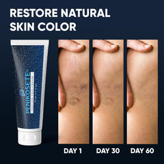 Penikosete jet-setter leg care emphasizes travel-friendly support
