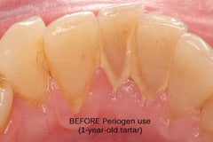 Three-bottle pack signals value and long-term tartar management.