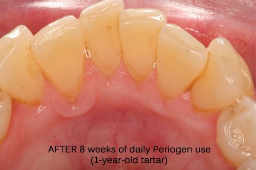 Periogen dentist endorsement image reflects trusted research support.