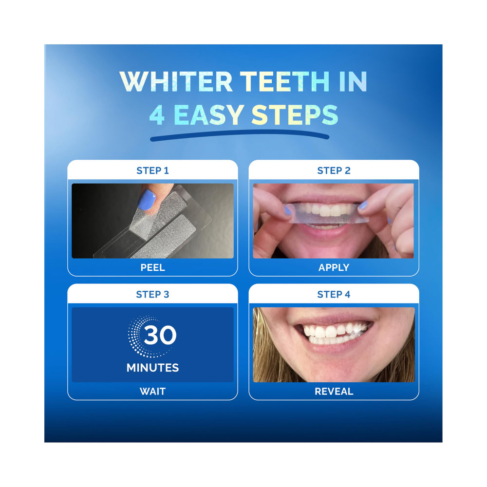 POP ON VENEERS strip applied to teeth for comfortable whitening