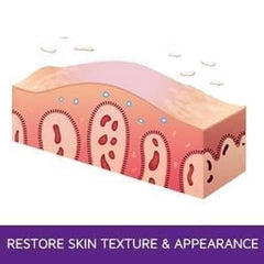 Prosoria ingredients include shea butter and vitamin E for nourishing skin