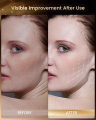 PRUNGO red light mask makes a thoughtful gift for skincare lovers