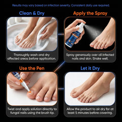 PUPCA Professional support team available for toenail treatment questions