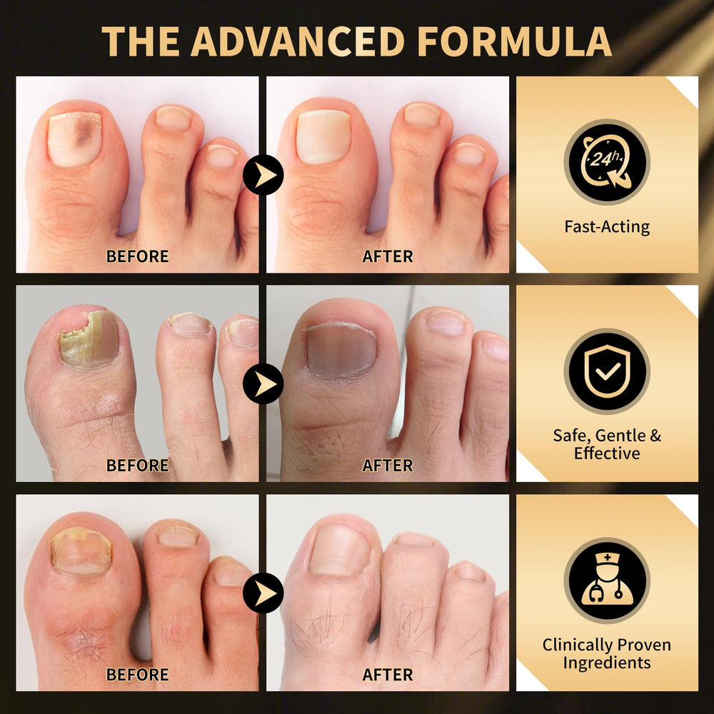 PUPCA treatment leaves skin feeling soft and refreshed after application.