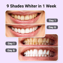 Puur Smile at-home whitening kit with simple, clear instructions