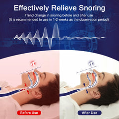 Redpee anti-snore device rechargeable via USB for travel use