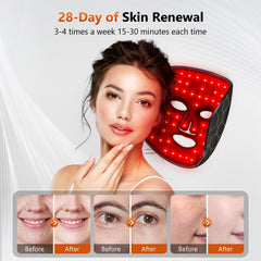 RELEXNOW LED mask close-up beads showing dense LED coverage.