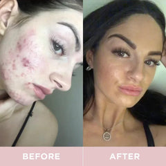 Revive Collagen Premium box showing 14 sachets for easy daily use.
