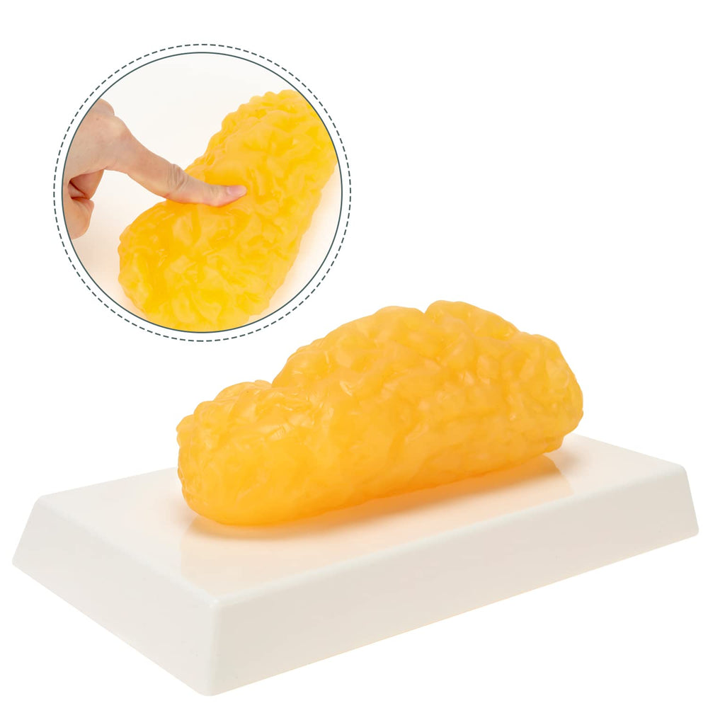 RONTEN fat model with display stand for classroom demonstrations and motivation