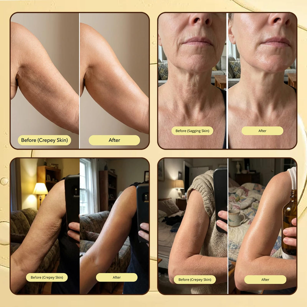Erae Queen Oil applied to arms for improved suppleness