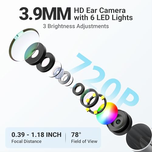 ScopeAround Otoscope delivers 720p imaging for clear canal details.