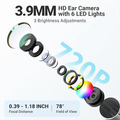 ScopeAround Otoscope delivers 720p imaging for clear canal details.