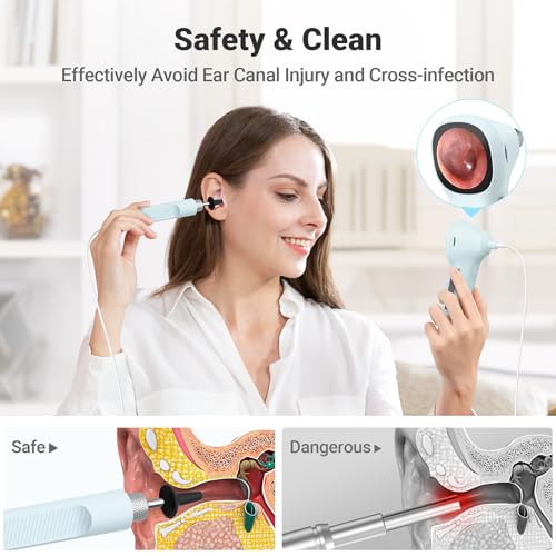 ScopeAround ergonomic grip supports steady handling during self-checks.