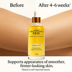 SDXJIOGE Erae Queen Oil tummy-area application promotes even hydration around midsection