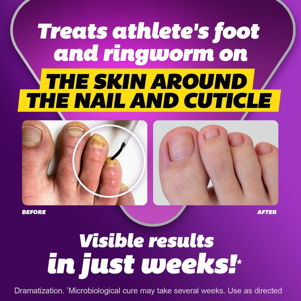 Close-up of the Silka brush tip for targeted nail care application.