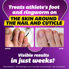 Close-up of the Silka brush tip for targeted nail care application.