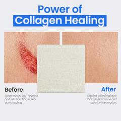 Simpurity collagen pad-cut-to-fit design adapts to wounds.